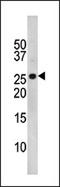 Cyclin Dependent Kinase Inhibitor 1B antibody, AP12668PU-N, Origene, Western Blot image 
