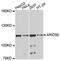 AT-Rich Interaction Domain 5B antibody, A10950, ABclonal Technology, Western Blot image 