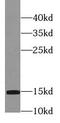 Profilin 2 antibody, FNab06343, FineTest, Western Blot image 
