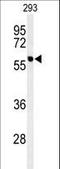 Protein Phosphatase, Mg2+/Mn2+ Dependent 1G antibody, LS-C101013, Lifespan Biosciences, Western Blot image 