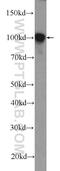 Actinin Alpha 1 antibody, 11313-2-AP, Proteintech Group, Western Blot image 