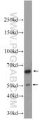 Choline O-Acetyltransferase antibody, 24418-1-AP, Proteintech Group, Western Blot image 