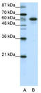 Cbl Proto-Oncogene Like 1 antibody, TA345405, Origene, Western Blot image 