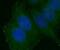 ERBB2 antibody, FNab03834, FineTest, Immunofluorescence image 