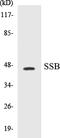 Small RNA Binding Exonuclease Protection Factor La antibody, EKC1540, Boster Biological Technology, Western Blot image 