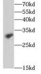 Interleukin 17 Receptor B antibody, FNab04230, FineTest, Western Blot image 