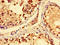 Solute Carrier Family 28 Member 3 antibody, orb46591, Biorbyt, Immunohistochemistry paraffin image 