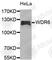 WD Repeat Domain 6 antibody, A5965, ABclonal Technology, Western Blot image 