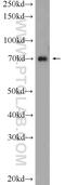 Heterochromatin Protein 1 Binding Protein 3 antibody, 24556-1-AP, Proteintech Group, Western Blot image 