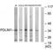 PDZ And LIM Domain 1 antibody, PA5-49758, Invitrogen Antibodies, Western Blot image 