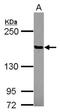 Protein Tyrosine Phosphatase Non-Receptor Type 14 antibody, NBP2-15070, Novus Biologicals, Western Blot image 