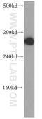 Inositol 1,4,5-Trisphosphate Receptor Type 1 antibody, 19962-1-AP, Proteintech Group, Western Blot image 