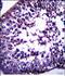 TSPY Like 5 antibody, PA5-48599, Invitrogen Antibodies, Immunohistochemistry paraffin image 