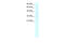 Asialoglycoprotein Receptor 2 antibody, 27-958, ProSci, Western Blot image 