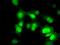Protein Phosphatase Methylesterase 1 antibody, MA5-25015, Invitrogen Antibodies, Immunocytochemistry image 