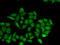 Interferon Regulatory Factor 8 antibody, STJ28362, St John