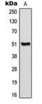 Corticotropin Releasing Hormone Receptor 1 antibody, LS-C353946, Lifespan Biosciences, Western Blot image 