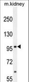 Mediator Complex Subunit 25 antibody, LS-C164119, Lifespan Biosciences, Western Blot image 