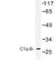 Complement C1q B Chain antibody, LS-C177449, Lifespan Biosciences, Western Blot image 