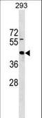 Zinc Finger Protein 331 antibody, LS-C157443, Lifespan Biosciences, Western Blot image 