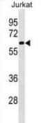 Pre-mRNA-splicing factor SLU7 antibody, abx030267, Abbexa, Western Blot image 