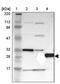 PRELI Domain Containing 1 antibody, PA5-52187, Invitrogen Antibodies, Western Blot image 