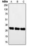 Myogenic Factor 5 antibody, LS-C352552, Lifespan Biosciences, Western Blot image 