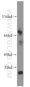 Colony Stimulating Factor 1 antibody, 14779-1-AP, Proteintech Group, Western Blot image 