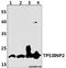 Dor antibody, A07881, Boster Biological Technology, Western Blot image 