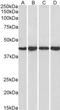 Protein Phosphatase 1 Regulatory Subunit 8 antibody, STJ70400, St John