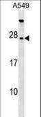 TBC1 Domain Family Member 28 antibody, LS-C161731, Lifespan Biosciences, Western Blot image 