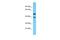 THUMP Domain Containing 1 antibody, A13443, Boster Biological Technology, Western Blot image 