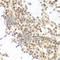 Polyhomeotic Homolog 1 antibody, A5843, ABclonal Technology, Immunohistochemistry paraffin image 