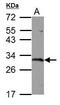 Glutathione S-transferase omega-1 antibody, PA5-31185, Invitrogen Antibodies, Western Blot image 