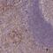 TNF Superfamily Member 12 antibody, PA5-62711, Invitrogen Antibodies, Immunohistochemistry paraffin image 