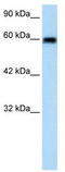 Bestrophin 4 antibody, TA338739, Origene, Western Blot image 