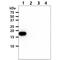 NME/NM23 Nucleoside Diphosphate Kinase 1 antibody, GTX57703, GeneTex, Western Blot image 