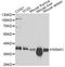 CD20 antibody, A1793, ABclonal Technology, Western Blot image 