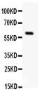 Somatostatin Receptor 1 antibody, LS-C312844, Lifespan Biosciences, Western Blot image 