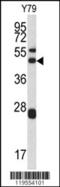 Actin Related Protein 2/3 Complex Subunit 1A antibody, MBS9211352, MyBioSource, Western Blot image 