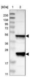 Protein Tyrosine Phosphatase Non-Receptor Type 2 antibody, NBP2-48528, Novus Biologicals, Western Blot image 