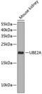 Ubiquitin Conjugating Enzyme E2 A antibody, 14-485, ProSci, Western Blot image 