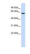 SPTLC1 antibody, NBP1-59644, Novus Biologicals, Western Blot image 