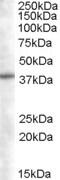 Sorting Nexin 16 antibody, 46-399, ProSci, Enzyme Linked Immunosorbent Assay image 