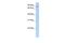 Mitochondrial TRNA Translation Optimization 1 antibody, GTX45372, GeneTex, Western Blot image 