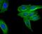 ATP Binding Cassette Subfamily C Member 2 antibody, NBP2-66958, Novus Biologicals, Immunocytochemistry image 