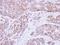 Keratin 8 antibody, GTX109489, GeneTex, Immunohistochemistry paraffin image 
