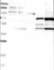 Kynurenine Aminotransferase 1 antibody, NBP1-83317, Novus Biologicals, Western Blot image 