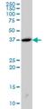 SH3 Domain Containing GRB2 Like 2, Endophilin A1 antibody, H00006456-M01, Novus Biologicals, Western Blot image 