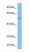 Cytidine/Uridine Monophosphate Kinase 2 antibody, GTX00670, GeneTex, Western Blot image 